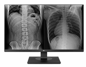 LG 27” UHD IPS Clinical Review Monitor (FREE Shipping)